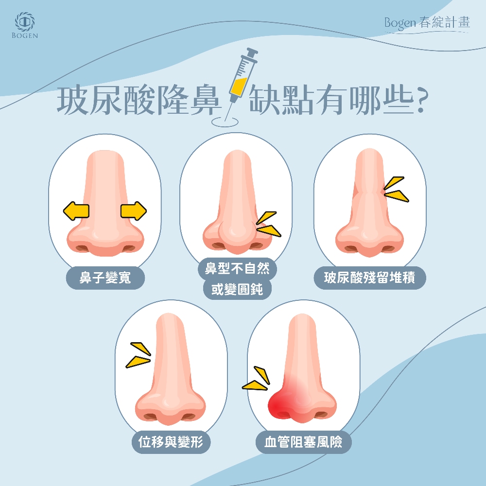 玻尿酸隆鼻缺點,玻尿酸隆鼻,博恩妍